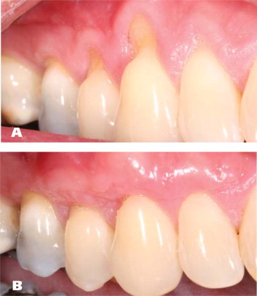 teeth heal by dentist in Aberdeen